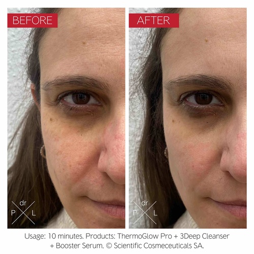 DR. LEVY SWITZERLAND The ThermoGlow Pro » buy online | NICHE BEAUTY