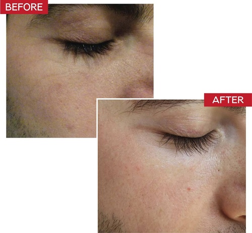 DR. LEVY SWITZERLAND Booster Serum » buy online | NICHE BEAUTY