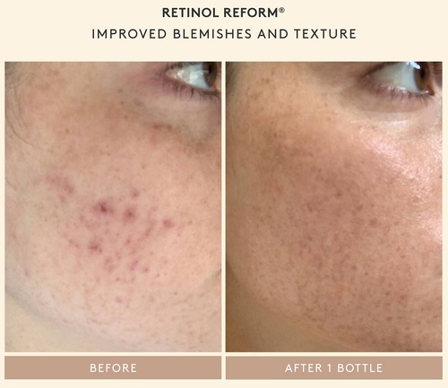 SHANI DARDEN Shani's Starter Set » buy online NICHE BEAUTY