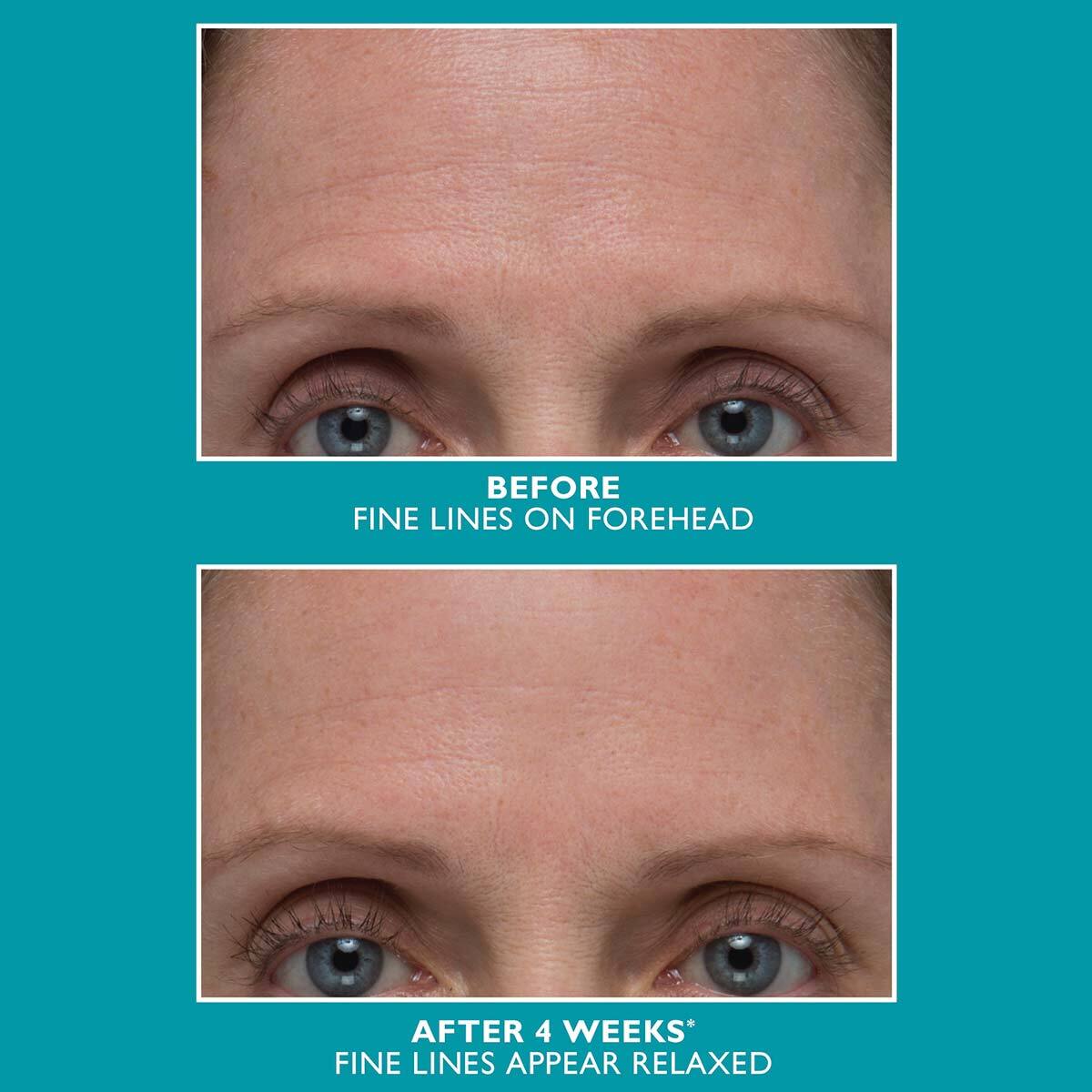 PETER THOMAS ROTH Peptide Skinjection™ Amplified Wrinkle-Fix Serum ...