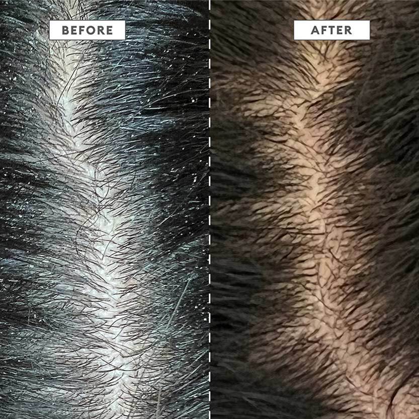 BRIOGEO MegaStrength + Dandruff Control Shampoo Charcoal + AHA/BHA ...