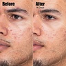 Sunday Riley Peacekeeper Salicylic + Azelaic Acid Serum