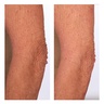 U Beauty The Sculpt Arm Compound