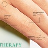 Kat Burki Hand Therapy