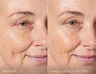 Medik8 Radiance Ritual