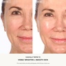 U Beauty Resurfacing Flash Peel