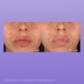 Dermalogica Stabilizing Repair Serum