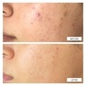 111Skin Dark Spot Correcting Serum