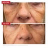 Dr. Levy Switzerland The Eye Longevity Ritual