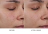 Westman Atelier Pore Refining Complex