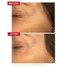 Dr. Levy Switzerland The Face Longevity Ritual