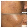 111Skin Dark Spot Correcting Serum