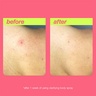 Dermalogica Clear Start Clarifying Body Spray