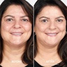 By Terry Brightening CC Foundation 4C