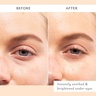 Patchology Skin Remedy Soothing Eye Gels