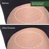 Murad Retinal Resculpt Body Treatment