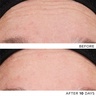 NOBLE PANACEA The Exceptional RetiNAD+ Renewal Booster