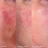 MANTLE The Calming Solution