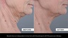 Zelens Collagen Solution Firming Serum for Face and Neck 10ml