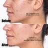 Sunday Riley Peacekeeper Salicylic + Azelaic Acid Serum