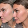 Vita Liberata Face Tan With Hyaluronic Acid & Niacinamide 20 ml