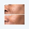 111Skin Precision Peel